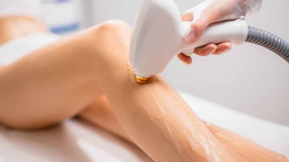 Comment se déroule une epilation laser en centre