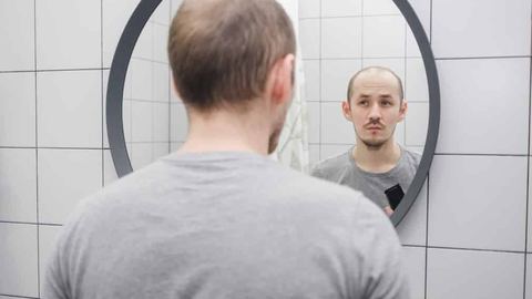 How to get rid of baldness permanently