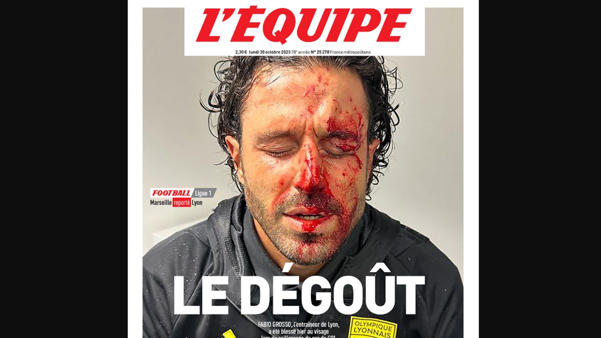 Fabio Grosso herido durante el partido OM-OL, su rostro ensangrentado es noticia