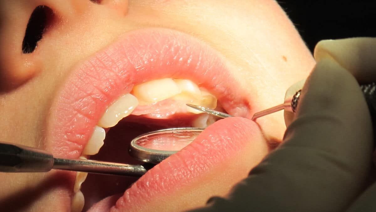 Invitation au dépistage des hépatites et du VIH pour plus de mille patients d'un dentiste de la Manche