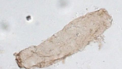 Fósil de 1.750 millones de años descubierto en Australia: nuevos conocimientos sobre el origen del oxígeno terrestre
