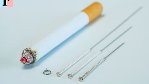 Acupuntura para dejar de fumar: técnicas y eficacia