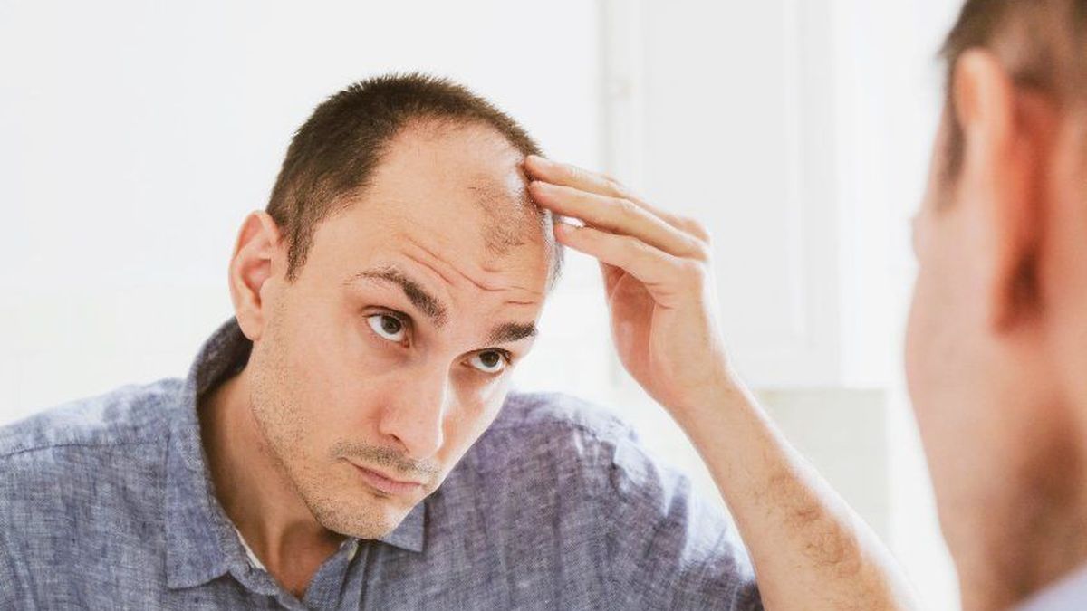 Prévenir la calvitie : quelles sont les solutions qui marchent ?