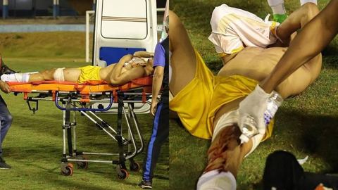 Un policía brasileño usa una bola flash contra el portero inmediatamente después del pitido final