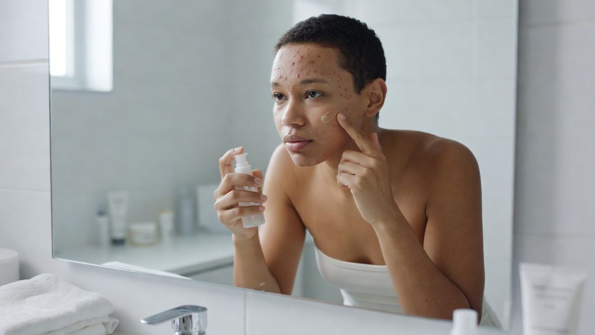 How to get rid of acne effectively